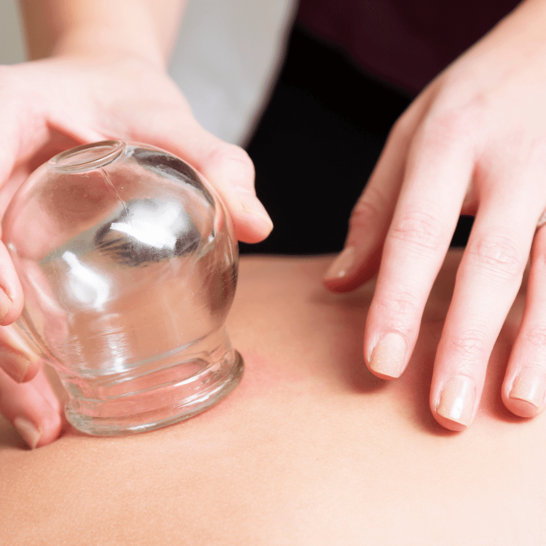 Training - Cupping Massage Training Course